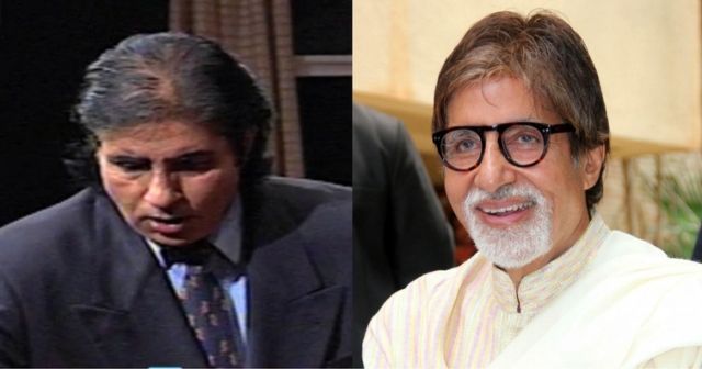 Greffe de cheveux Amitabh Bachchan