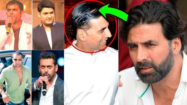 Gwiazdy Bollywood, które przeszły przeszczep włosów