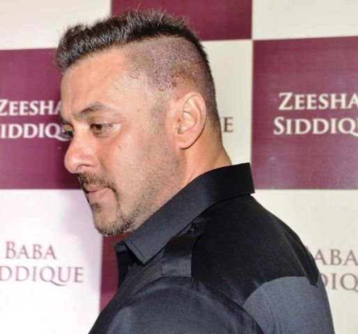 Salman Khan - infektion med hårtransplantation