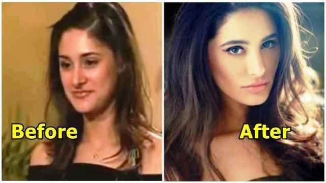 Nargis Fakhri prije i poslije
