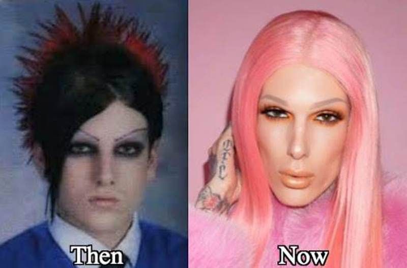 Jeffree Star prije i nakon plastičnih operacija