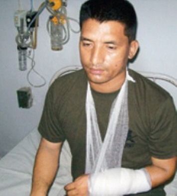 Bishnu Shrestha bị thương